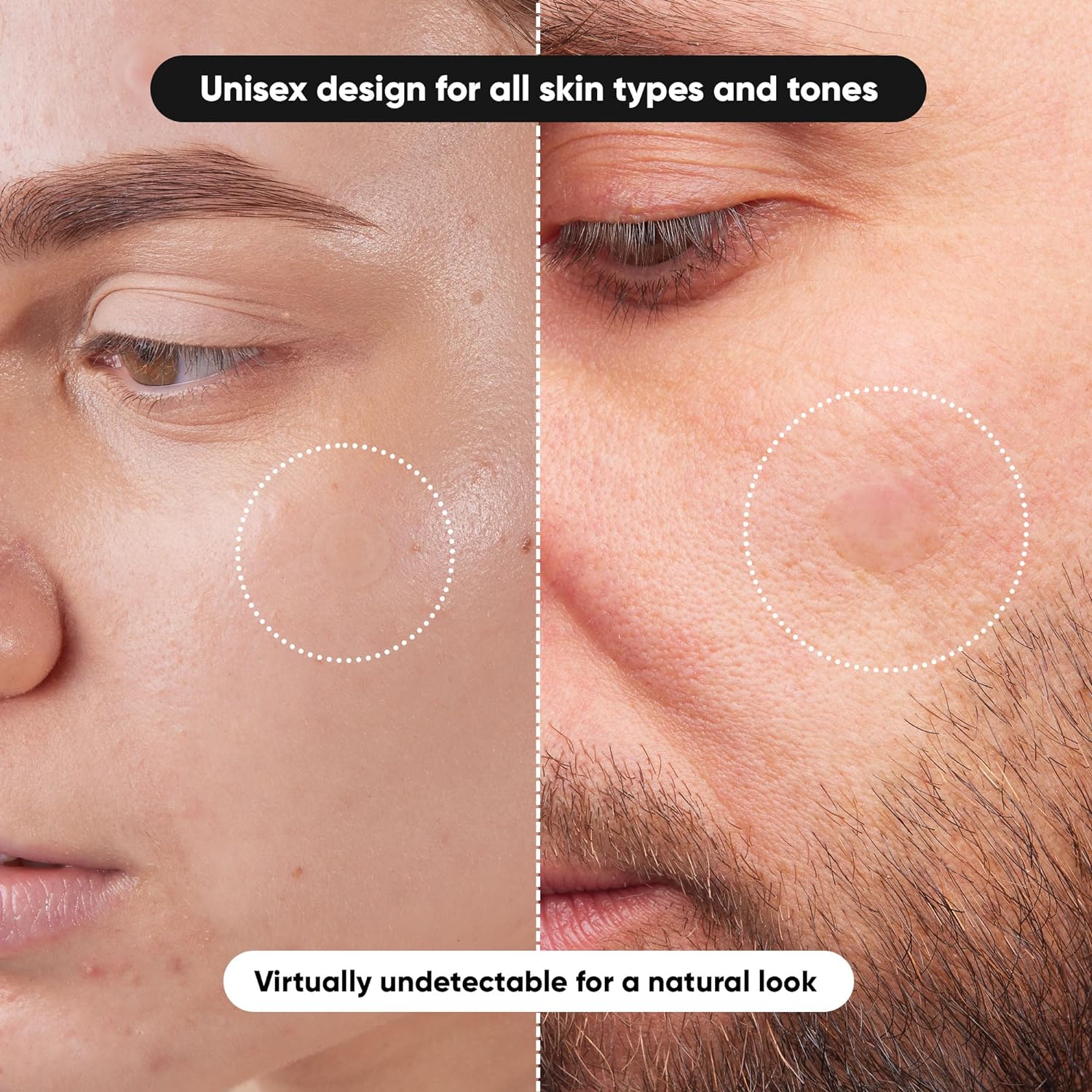 80/ 800PCS Hydrocolloid Acne P - огляд і ціна Healing Wellness
